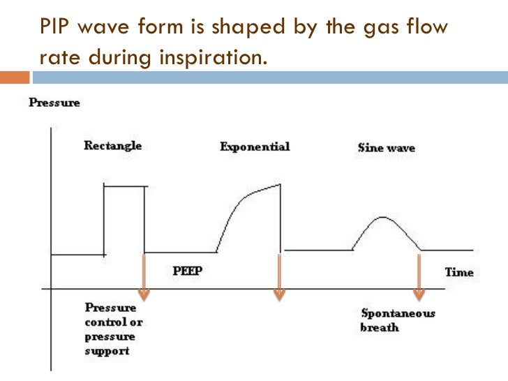 Basics of neonatal ventilation 1