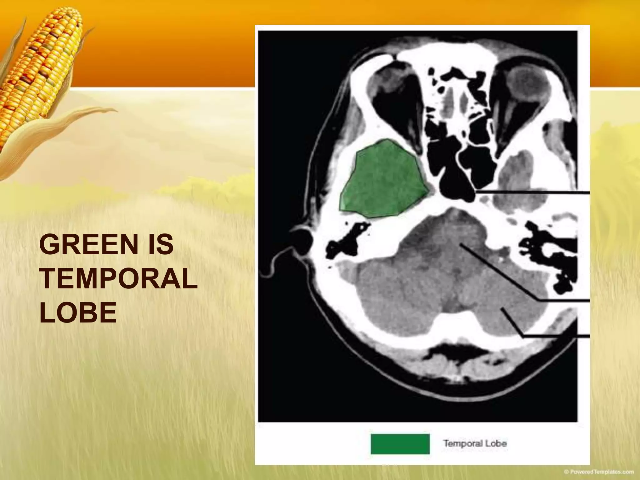 GREEN IS
TEMPORAL
LOBE
 