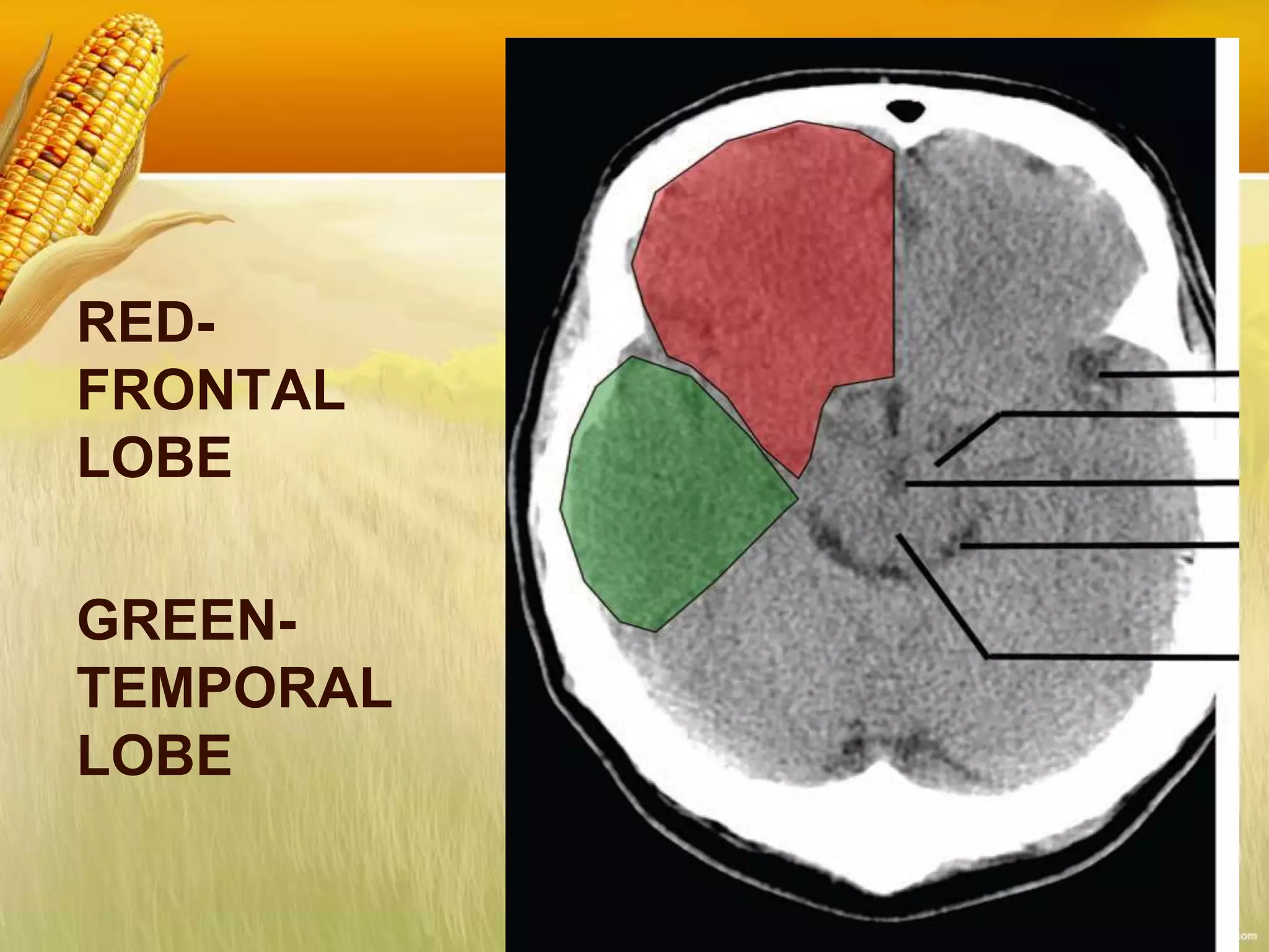 RED-
FRONTAL
LOBE
GREEN-
TEMPORAL
LOBE
 