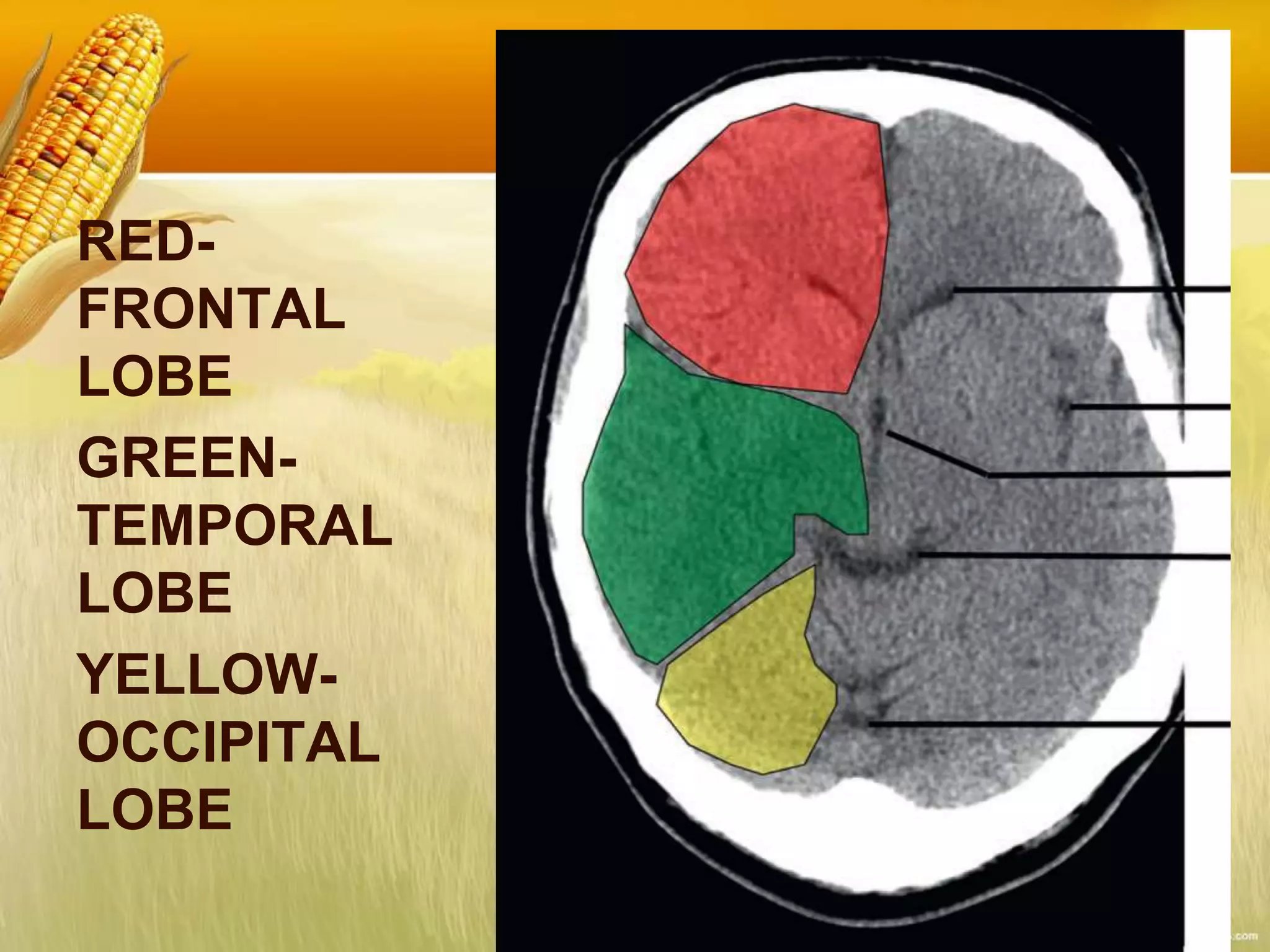 RED-
FRONTAL
LOBE
GREEN-
TEMPORAL
LOBE
YELLOW-
OCCIPITAL
LOBE
 
