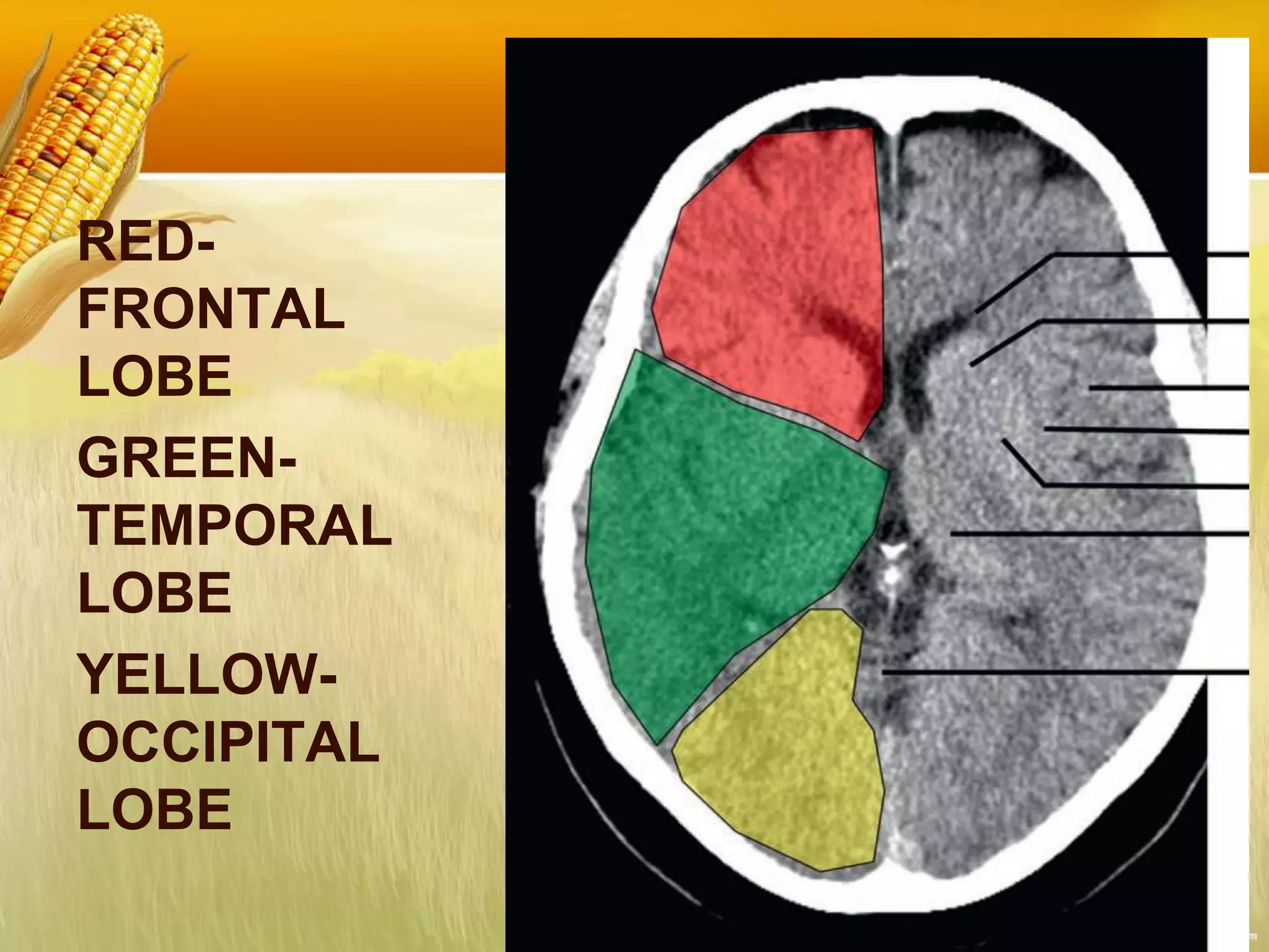 RED-
FRONTAL
LOBE
GREEN-
TEMPORAL
LOBE
YELLOW-
OCCIPITAL
LOBE
 