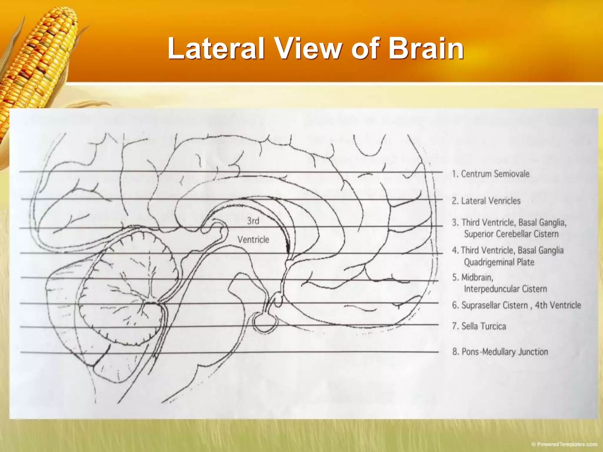 Lateral View of Brain
 