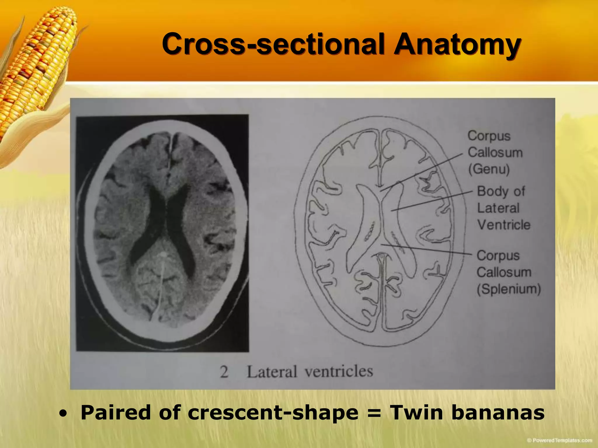Cross-sectional Anatomy
• Paired of crescent-shape = Twin bananas
 