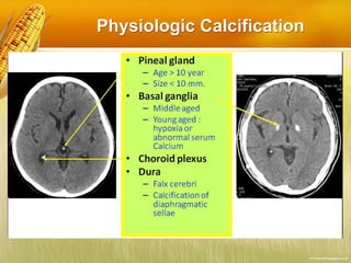 Physiologic Calcification
 