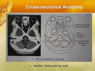 Cross-sectional Anatomy
• Orbits, Ethmoid air cell
 
