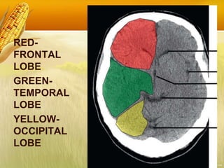 RED-
FRONTAL
LOBE
GREEN-
TEMPORAL
LOBE
YELLOW-
OCCIPITAL
LOBE
 