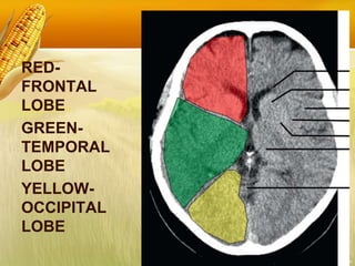 RED-
FRONTAL
LOBE
GREEN-
TEMPORAL
LOBE
YELLOW-
OCCIPITAL
LOBE
 