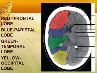 RED –FRONTAL
LOBE
BLUE-PARIETAL
LOBE
GREEN-
TEMPORAL
LOBE
YELLOW-
OCCIPITAL
LOBE
 