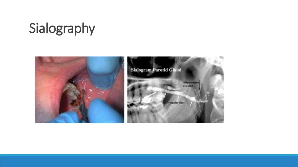 Basics of oral radiology