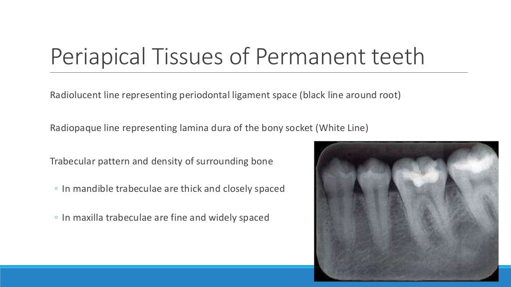 Basics of oral radiology