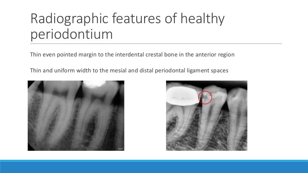 Basics of oral radiology