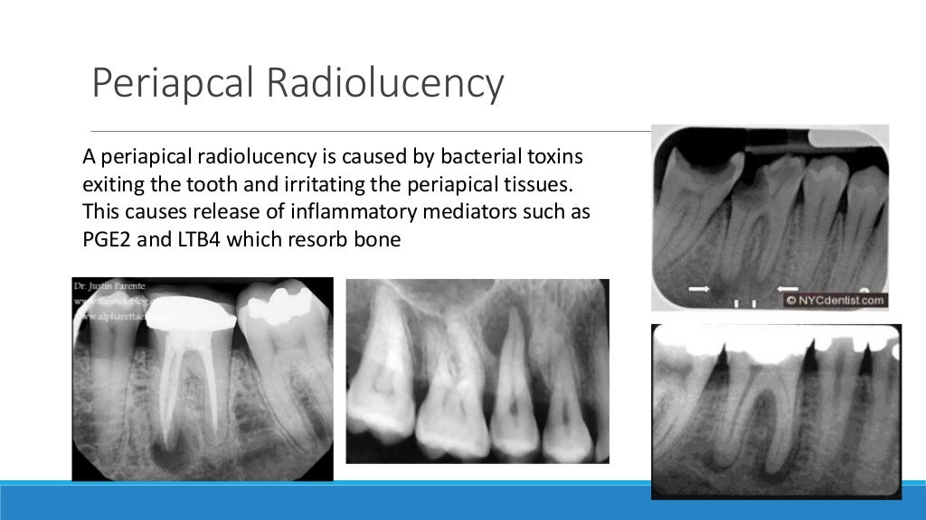 Basics of oral radiology