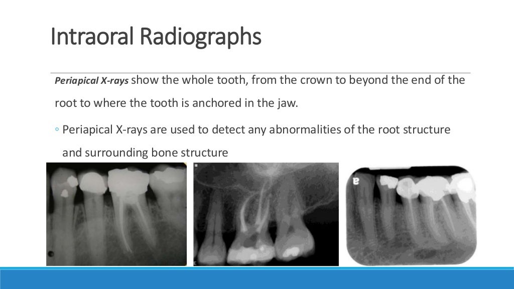 Basics of oral radiology