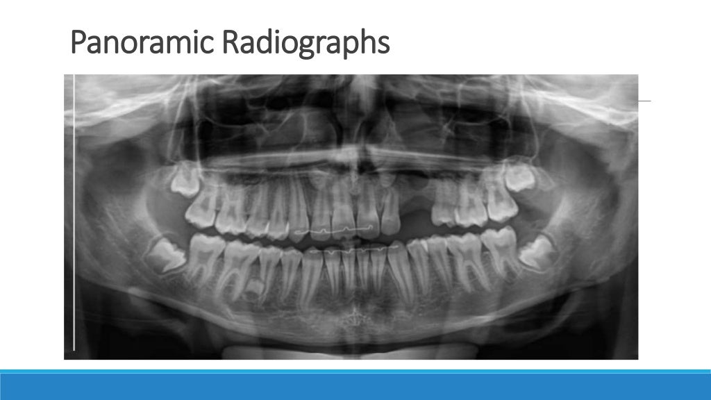 Basics of oral radiology