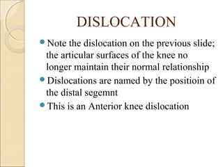 Dislocation Notes Basics of orthopedic radiology | PPT
