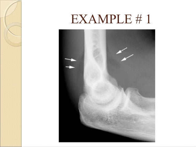Basics of orthopedic radiology