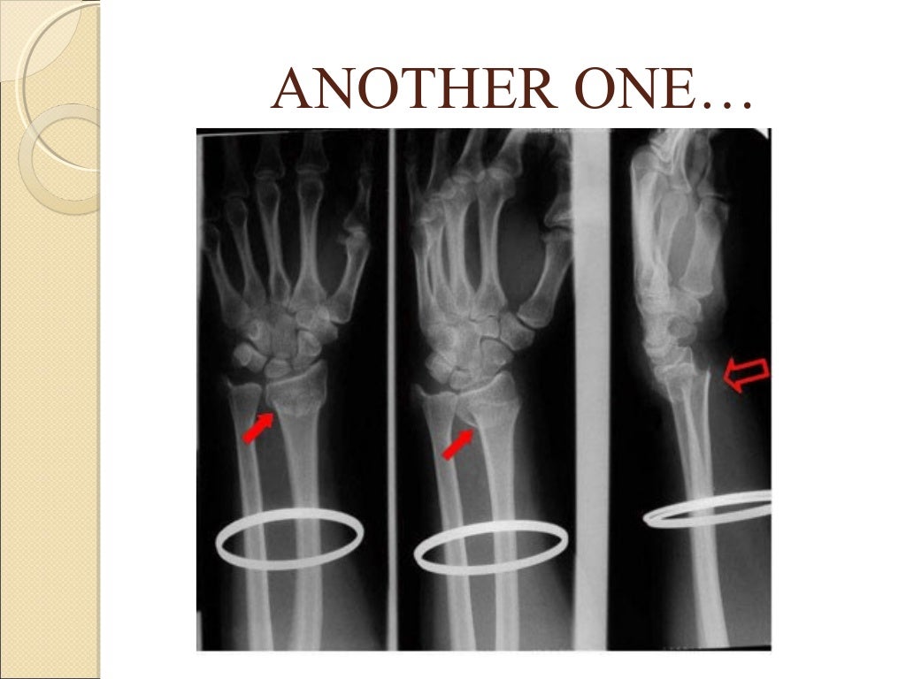 Basics of orthopedic radiology