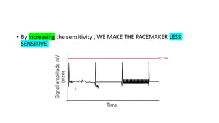 Basics of Pacemaker Dr Hafeesh Fazulu Pushpagiri | PPTX