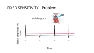 Basics of Pacemaker Dr Hafeesh Fazulu Pushpagiri | PPTX