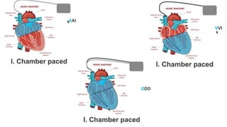 Basics of Pacemaker Dr Hafeesh Fazulu Pushpagiri | PPTX