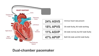 Basics of Pacemaker Dr Hafeesh Fazulu Pushpagiri | PPTX