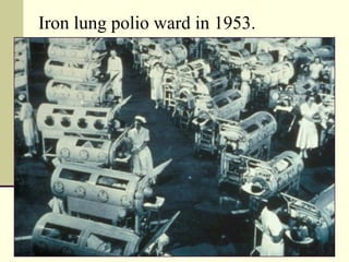 Iron lung polio ward in 1953.
 