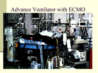 Advance Ventilator with ECMO
 