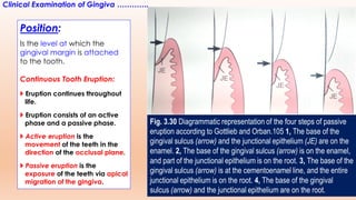 Apical Direction Basics of periodontology diagnosis and treatment | PDF