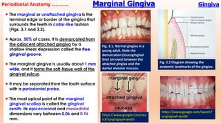 Normal Gingiva Basics of periodontology diagnosis and treatment | PDF