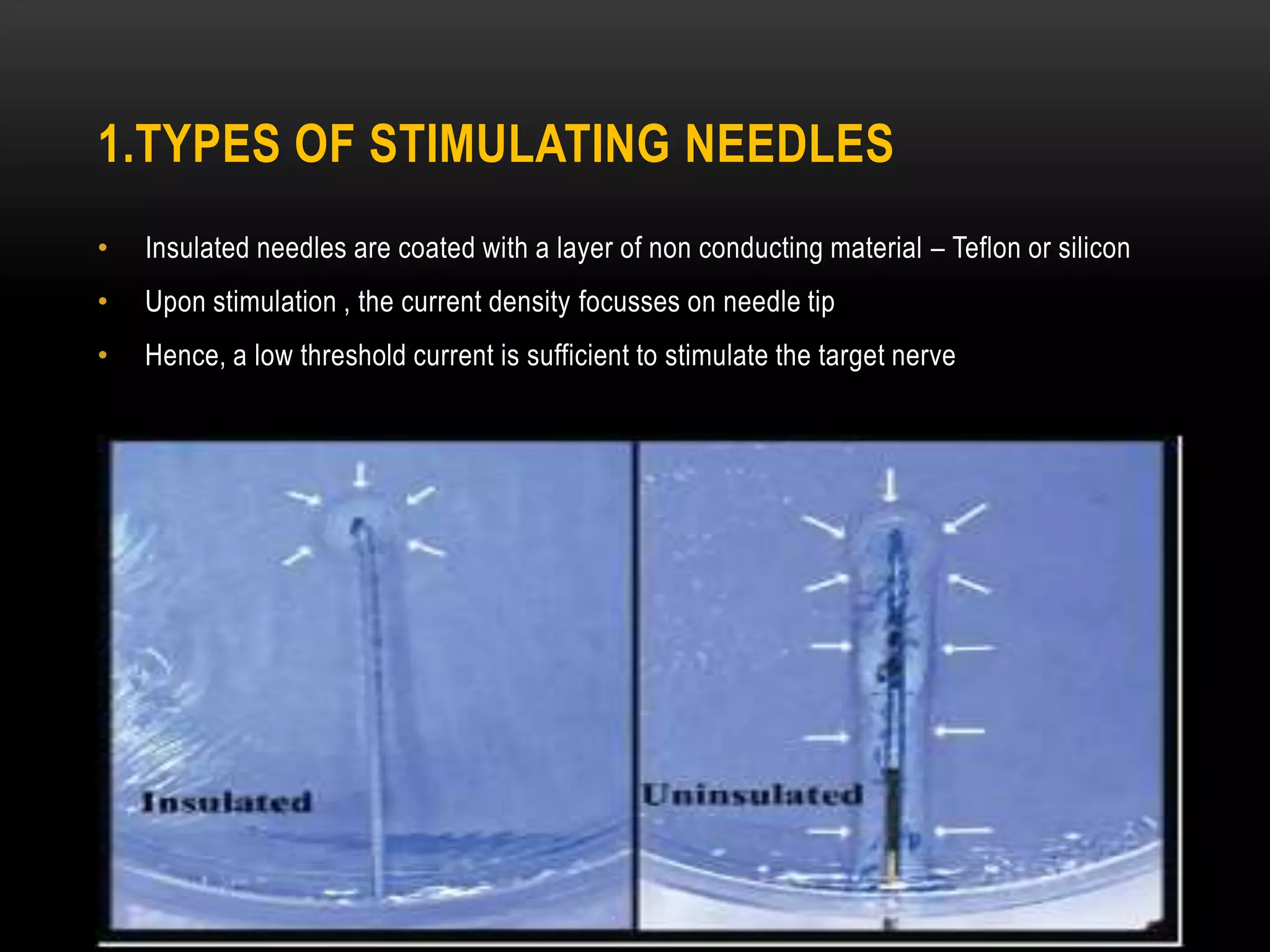 1.TYPES OF STIMULATING NEEDLES
• Insulated needles are coated with a layer of non conducting material – Teflon or silicon
• Upon stimulation , the current density focusses on needle tip
• Hence, a low threshold current is sufficient to stimulate the target nerve
 