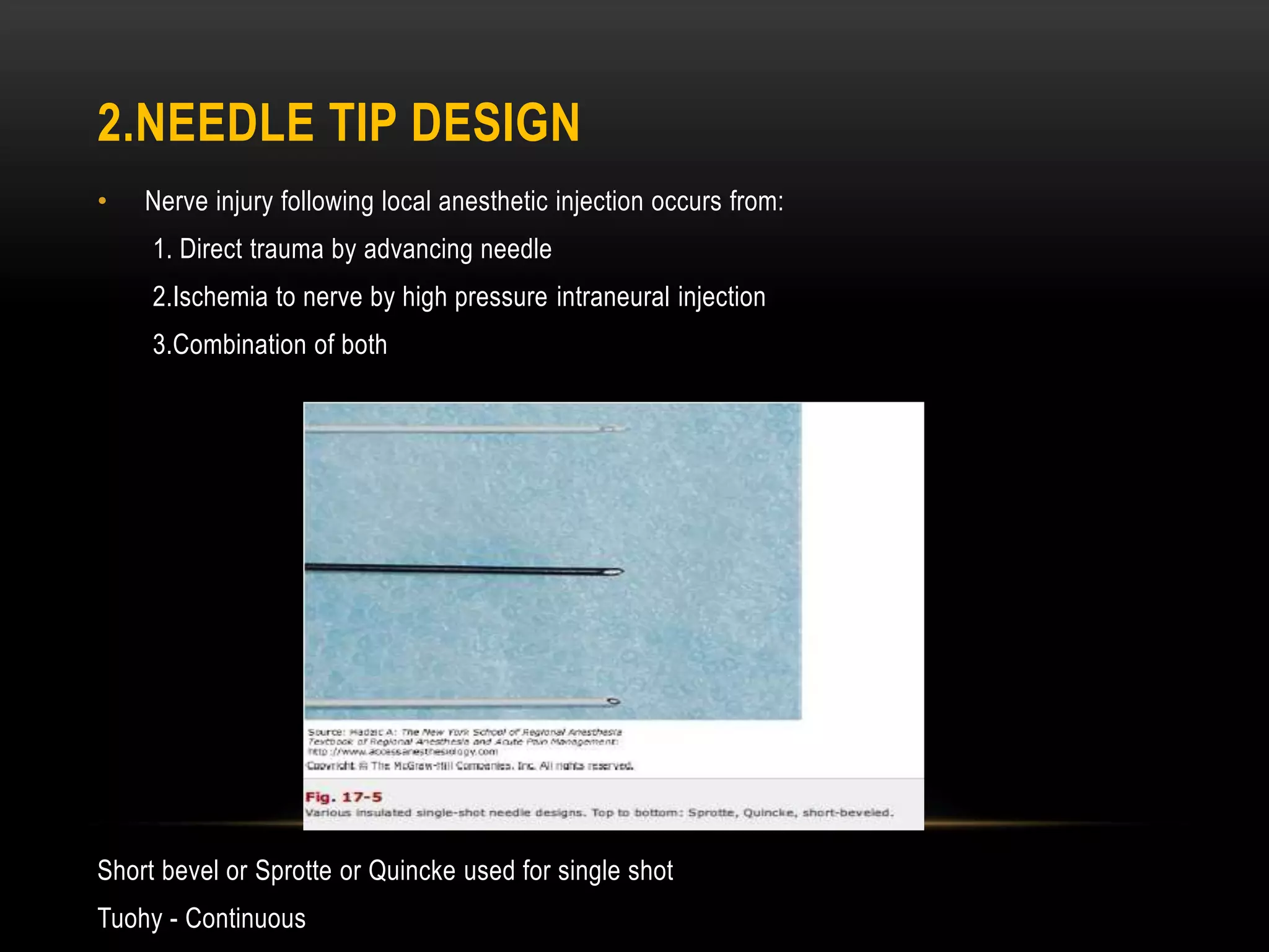 2.NEEDLE TIP DESIGN
• Nerve injury following local anesthetic injection occurs from:
1. Direct trauma by advancing needle
2.Ischemia to nerve by high pressure intraneural injection
3.Combination of both
Short bevel or Sprotte or Quincke used for single shot
Tuohy - Continuous
 