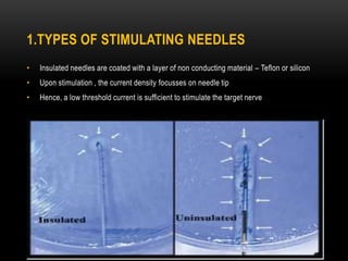 1.TYPES OF STIMULATING NEEDLES
• Insulated needles are coated with a layer of non conducting material – Teflon or silicon
• Upon stimulation , the current density focusses on needle tip
• Hence, a low threshold current is sufficient to stimulate the target nerve
 