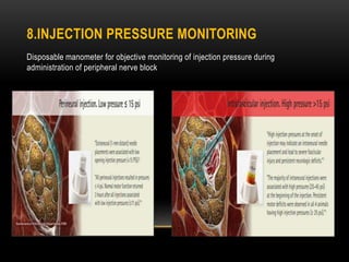 8.INJECTION PRESSURE MONITORING
Disposable manometer for objective monitoring of injection pressure during
administration of peripheral nerve block
 