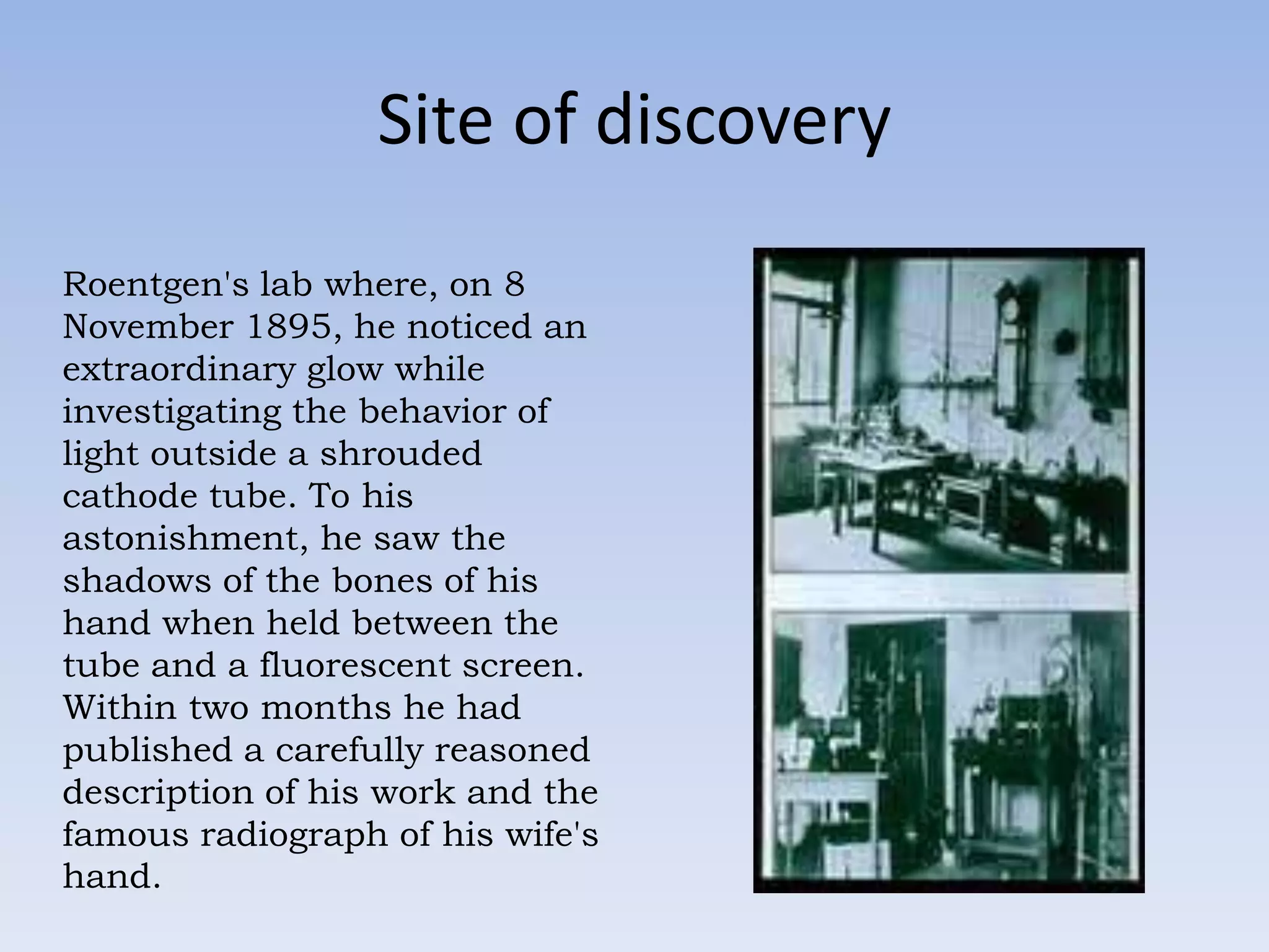 Site of discovery
Roentgen's lab where, on 8
November 1895, he noticed an
extraordinary glow while
investigating the behavior of
light outside a shrouded
cathode tube. To his
astonishment, he saw the
shadows of the bones of his
hand when held between the
tube and a fluorescent screen.
Within two months he had
published a carefully reasoned
description of his work and the
famous radiograph of his wife's
hand.

 