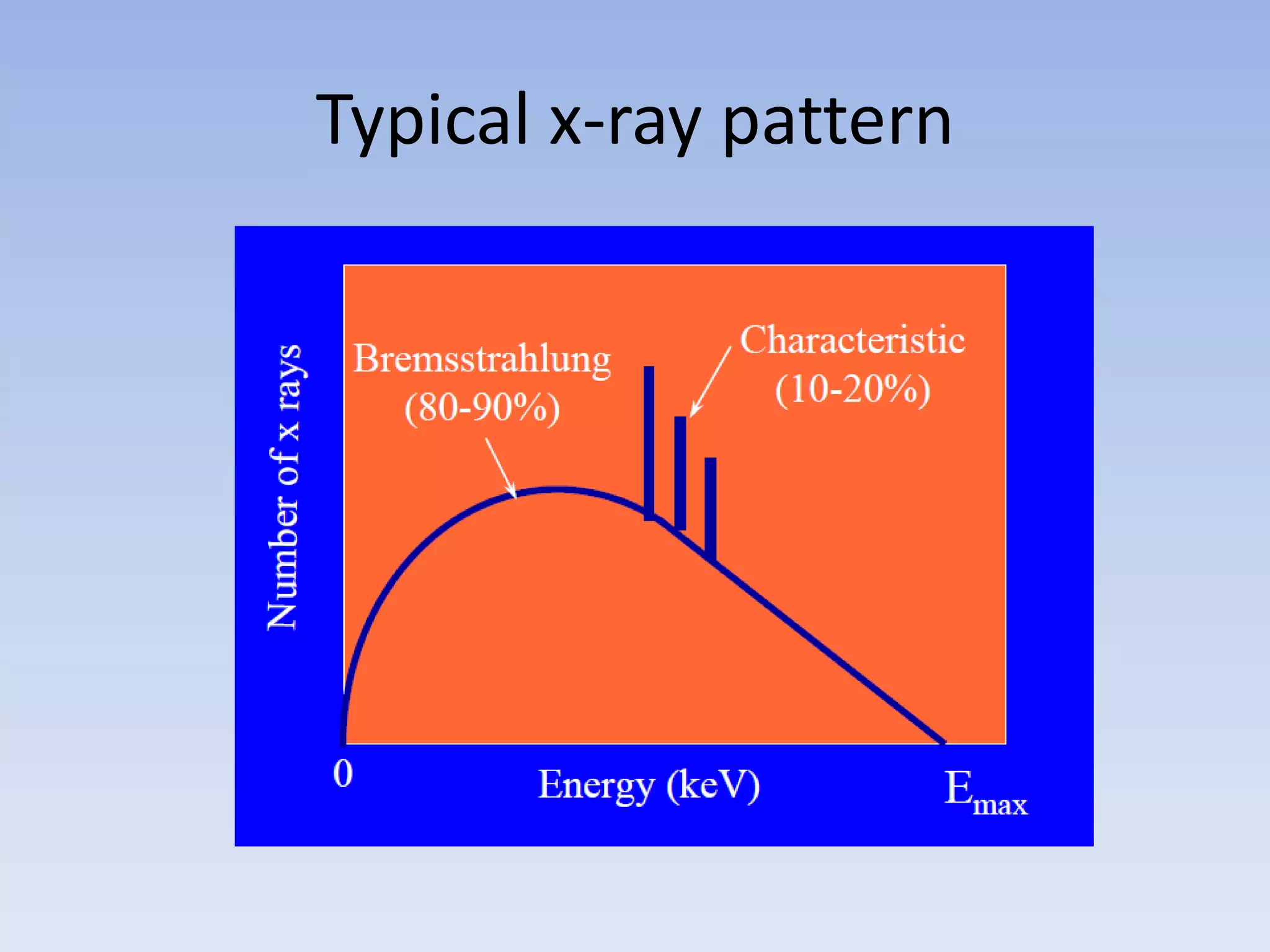 Typical x-ray pattern

 