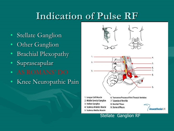 Basics of radio frequency techniques in pain management jadon.a