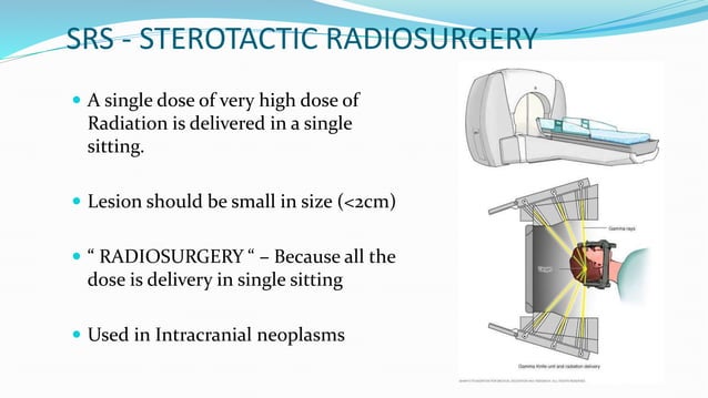 BASICS OF RADIATION THERAPY/RADIATION ONCOLOGY | PPTX | Cancer ...
