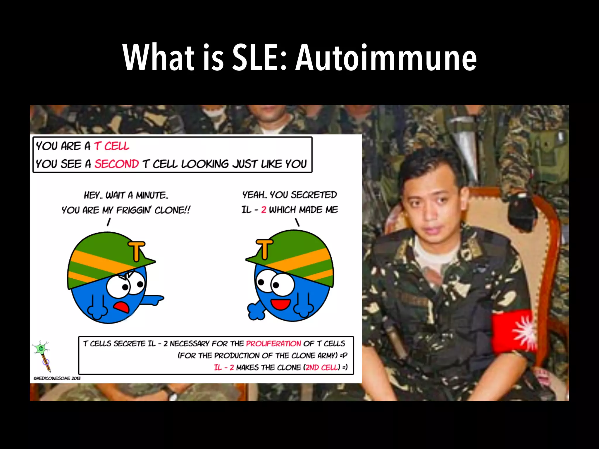 What is SLE: Autoimmune
 