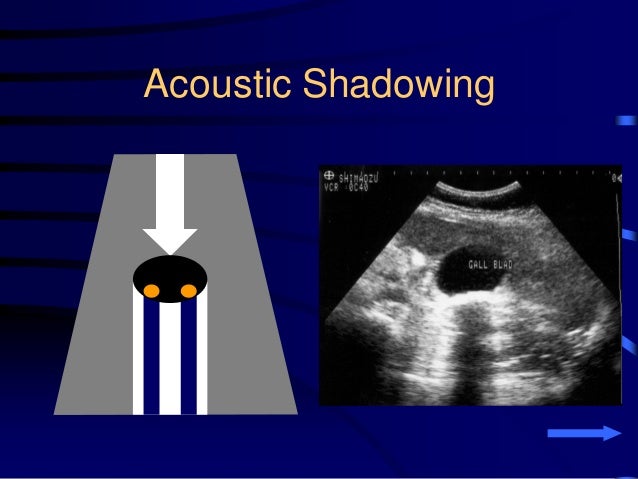 Sudanese Chest Sonography Workshop (Basics of sonography and anatomy