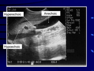 Basics of sonography and anatomy of chest wall | PDF