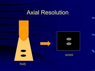 Example Axial Resolution Scan Basics of sonography and anatomy of chest wall | PDF