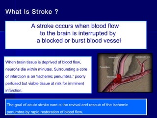 Basics of stroke(CVA) Management | PPT