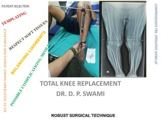 TOTAL KNEE REPLACEMENT
DR. D. P. SWAMI
PATIENT SELECTION
COMPREHENSIVEPREOPERATIVEWORKUP
EXTENSIVEDISCUSSIONAMONGOPERATINGTEAM
ROBUST SURGICAL TECHNIQUEDPS "ONLY FOR EDUCATIONAL PURPOSES"
 