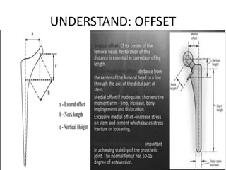 Left Helical Offset Basics of total hip replacement by DR. D. P. SWAMI | PPTX