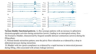 Basics of urodynamics in children and its usual presenation | PPTX