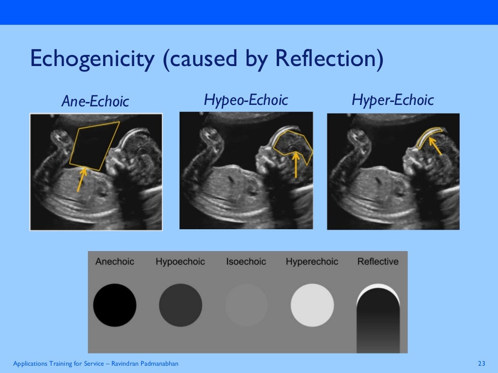 Basics Physics of ultrasound