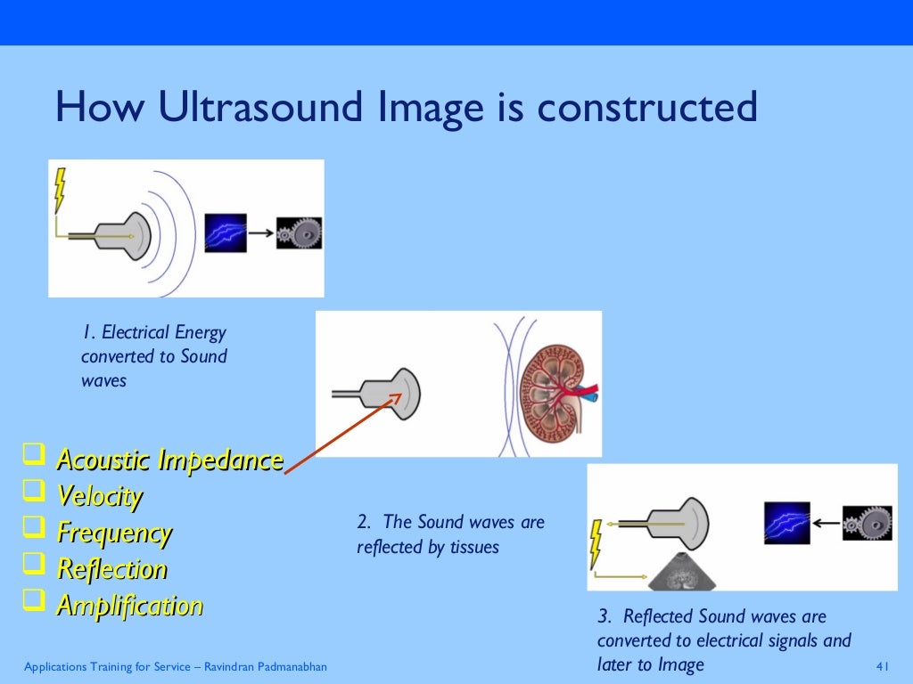 Basics Physics of ultrasound