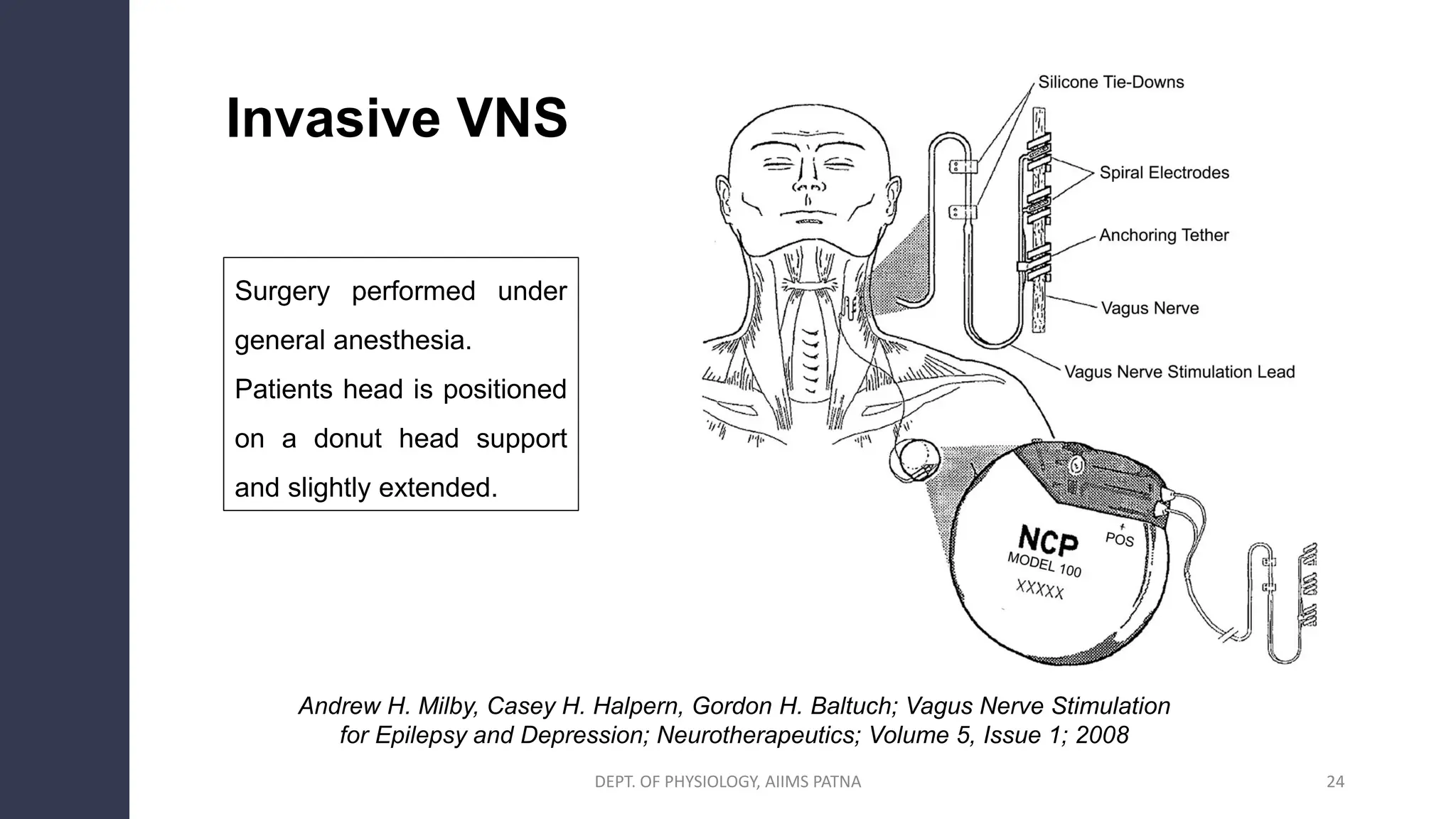 Vagus Nerve Stimulation Side Effects Glp 1 Reference: Basics Of Vagal Nerve Stimulation Vns