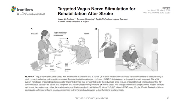 Basics of Vagal Nerve Stimulation (VNS) | PDF