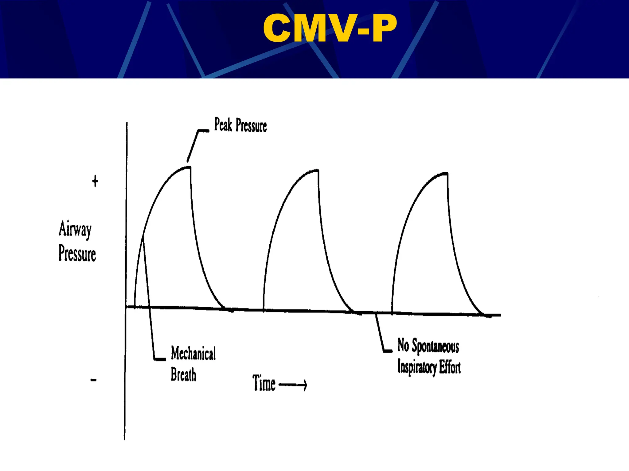CMV-P
 